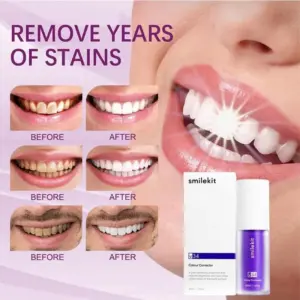 Hismile V34 Purple Whitening Toothpaste - Remove Stains, Reduce Yellowing, and Brighten Teeth for a Fresh, Healthy Smile