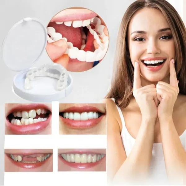Snap On Smile Veneers Teeth For Men And Women Moldable False Artificial Braces Teeth Kits - Image 6